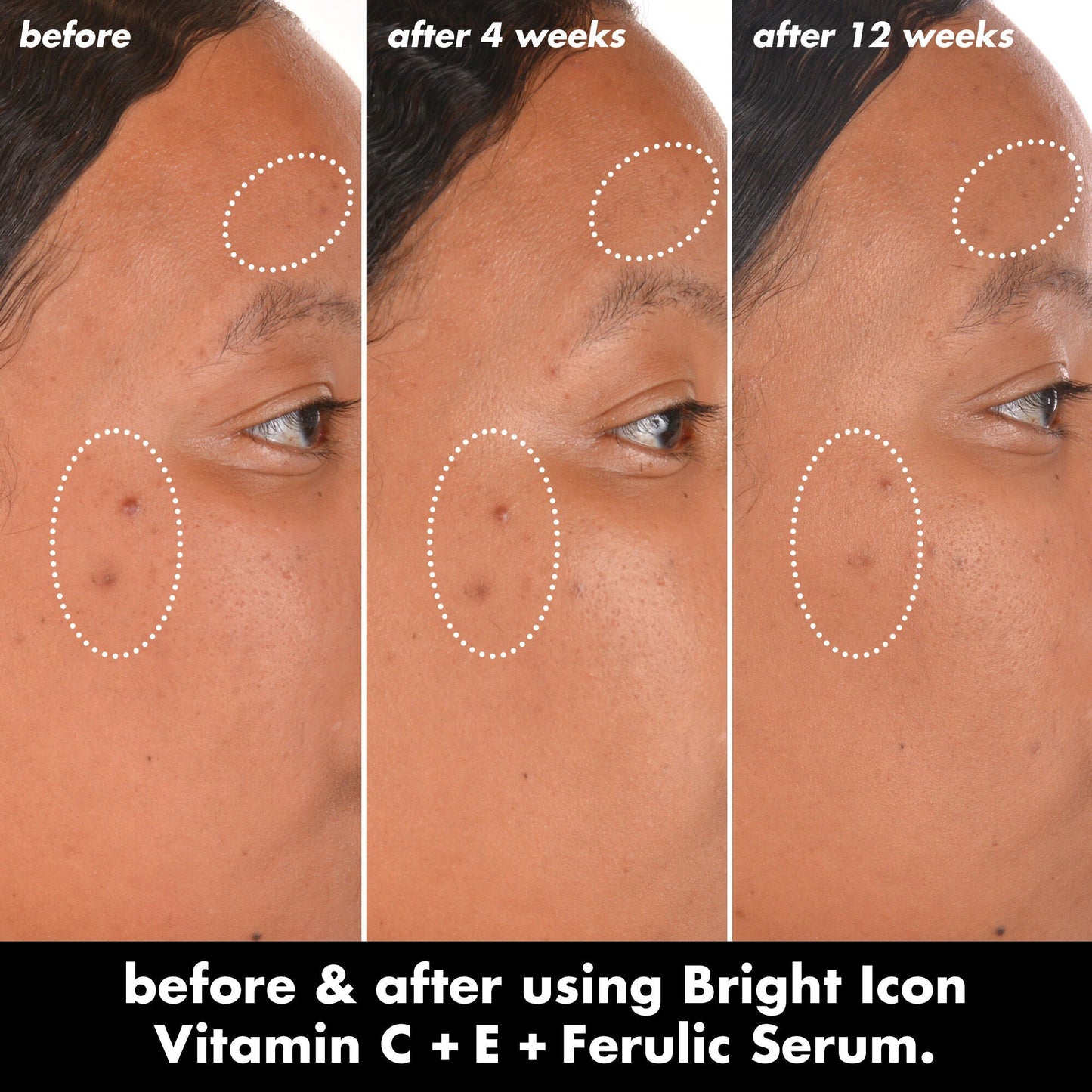 bright-icon-vitamin-c-e-ferulic-serum-s6 0226_EDU_BrightIconVitC_BA_Chanel_TRIPTYCH_c58f2fc8-209d-414f-9ba3-666a07a94887.jpg