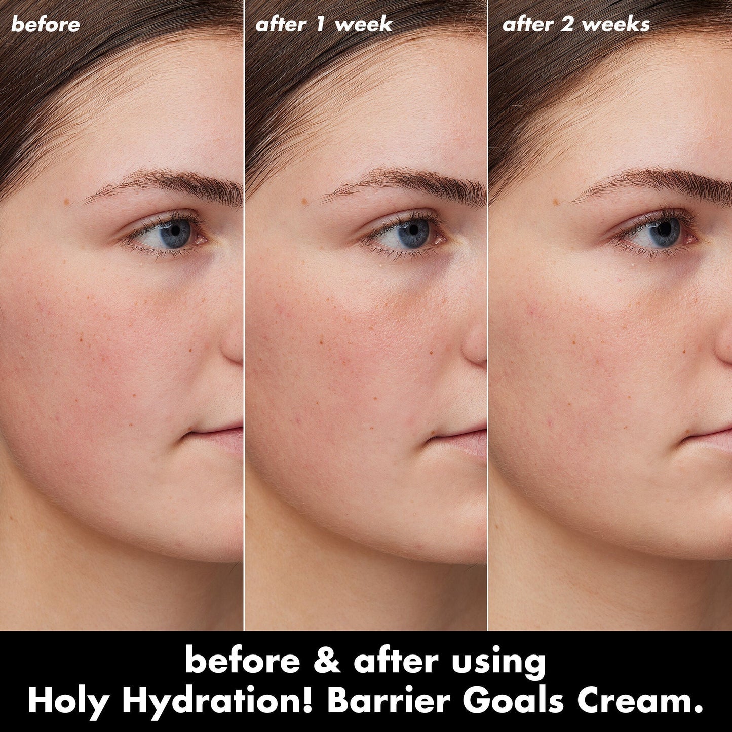 holy-hydration-barrier-goals-cream-mini-z2 0226_EDU_HHBarrierGoalsCream_B_A_Zoe_TRYPTICH_4f0e5b5d-35fb-4020-968e-244d4536afbd.jpg