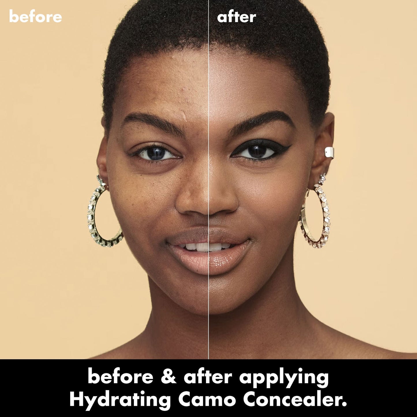hydrating-camo-concealer-z2 0226_EDU_HydratingCamoConcelaer_BA_AshleyKaresh_20_1_d8499bbf-0e91-4173-b5e2-75127caf83a3.jpg