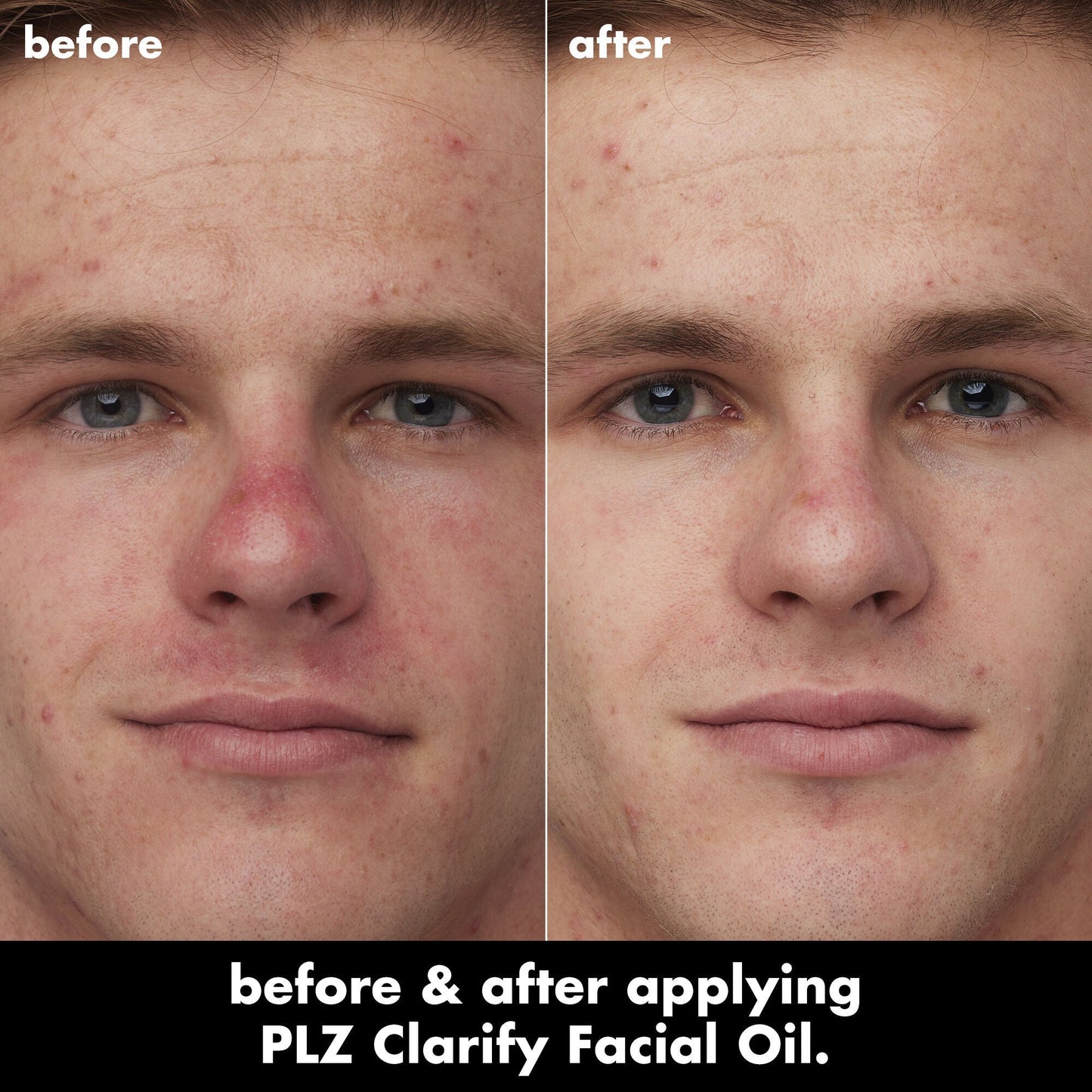 plz-clarify-facial-oil-v3 0326_EDU_PlzClarify_BA_Caleb.jpg