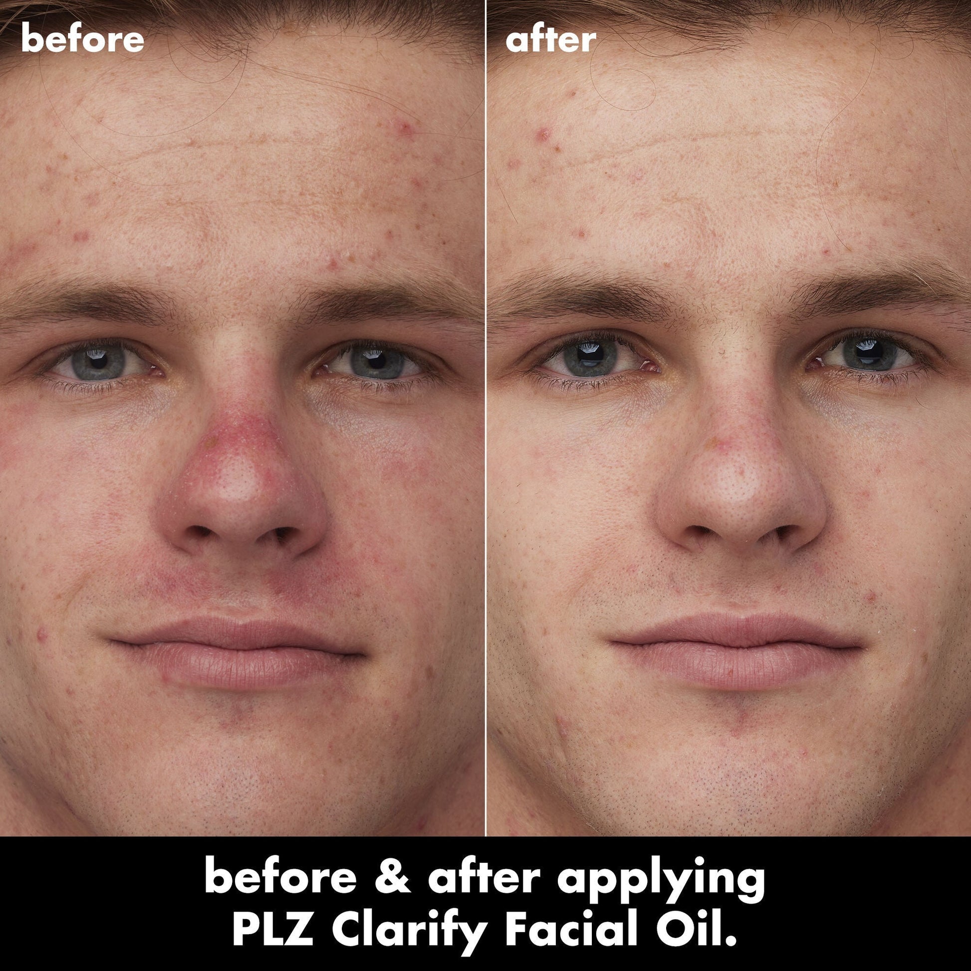 plz-clarify-facial-oil-v3 0326_EDU_PlzClarify_BA_Caleb.jpg