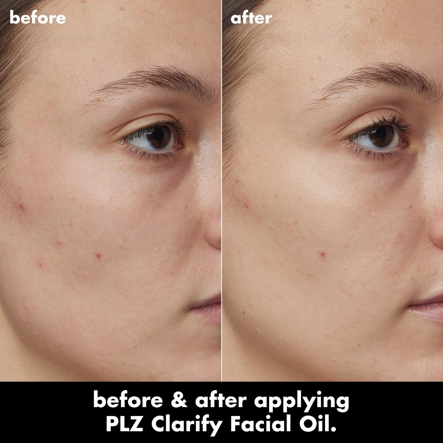 plz-clarify-facial-oil-v3 0326_EDU_PlzClarify_BA_Kelly.jpg
