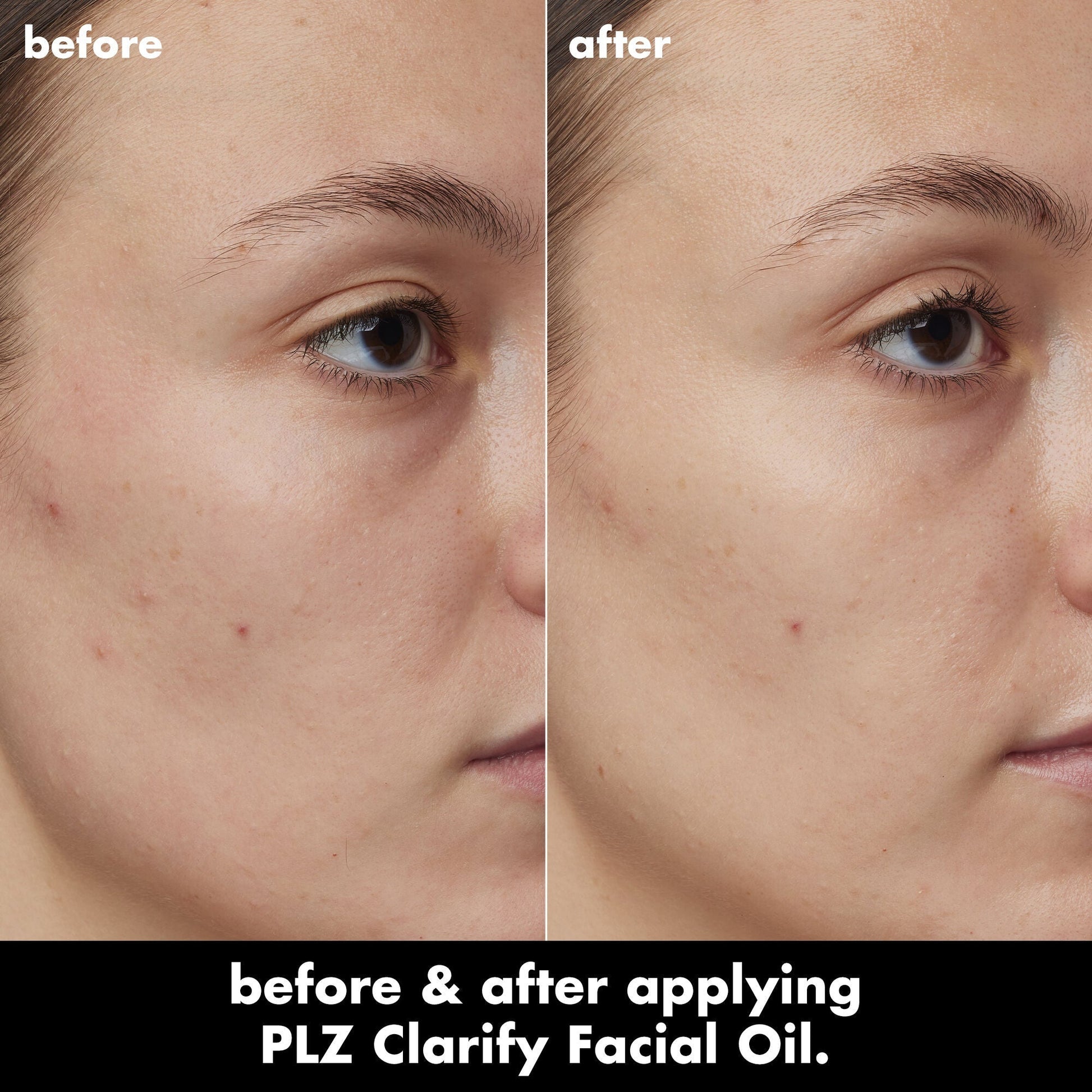 plz-clarify-facial-oil-v3 0326_EDU_PlzClarify_BA_Kelly.jpg