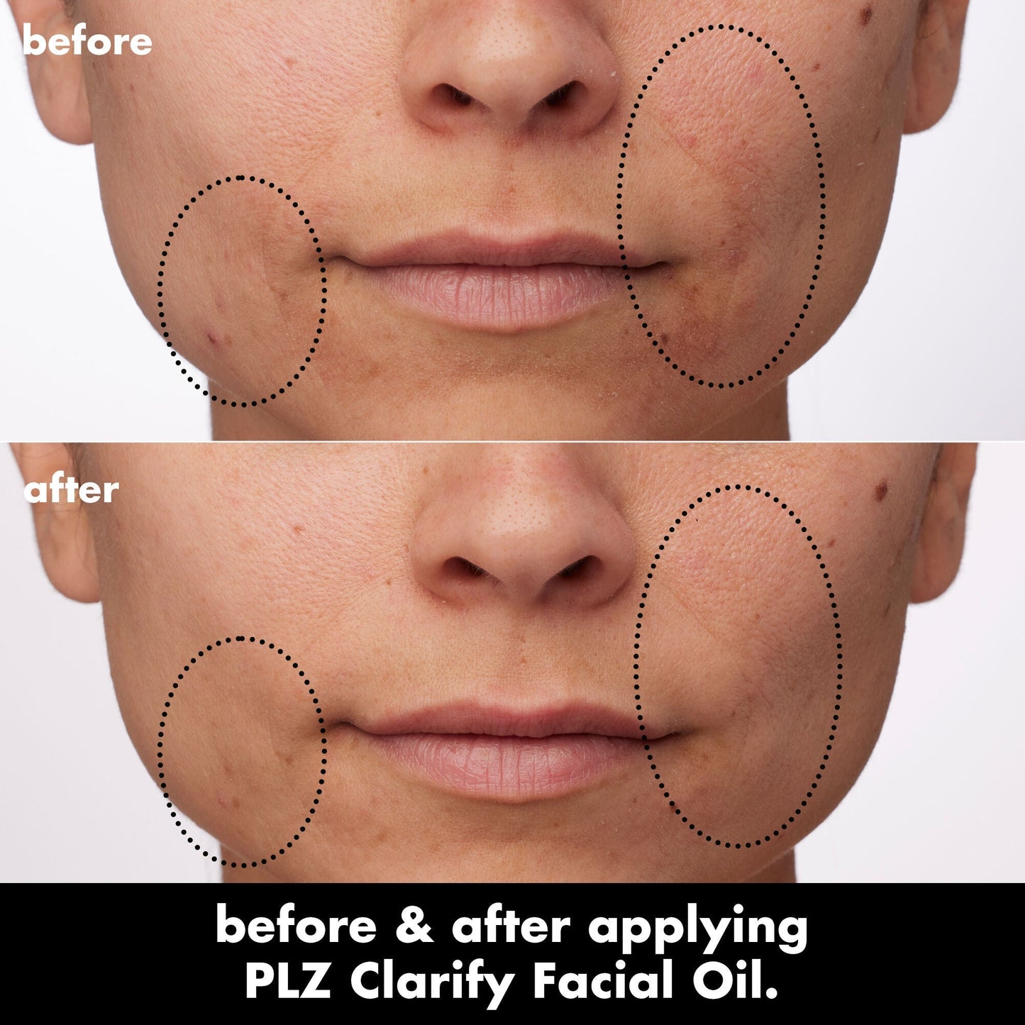 plz-clarify-facial-oil-v3 0326_EDU_PlzClarify_BA_Paula.jpg
