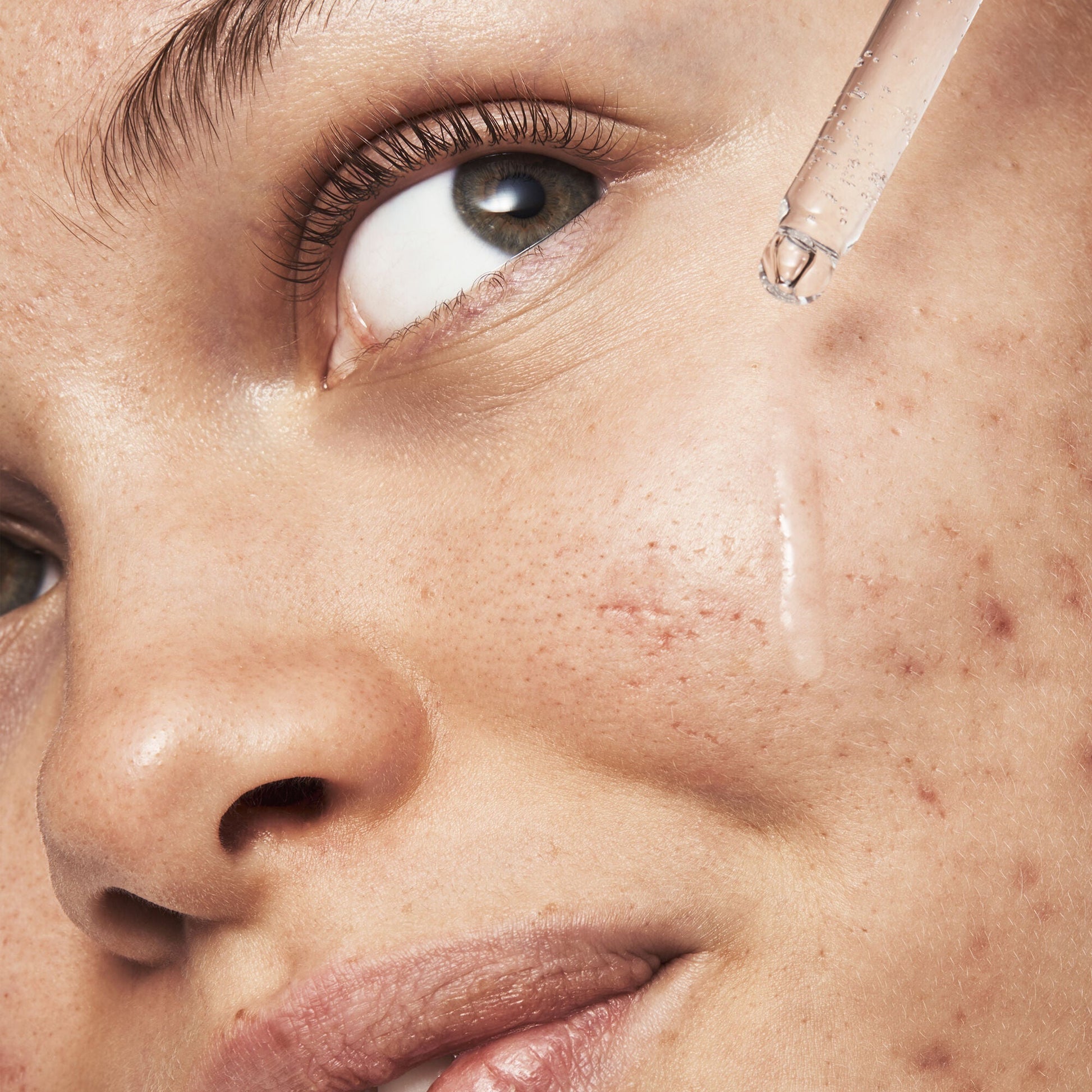 blemish-breakthrough-triple-acid-resurfacing-serum-z6 121321_Marley-Acne-Regimen_0254_FINAL_IGF.jpg
