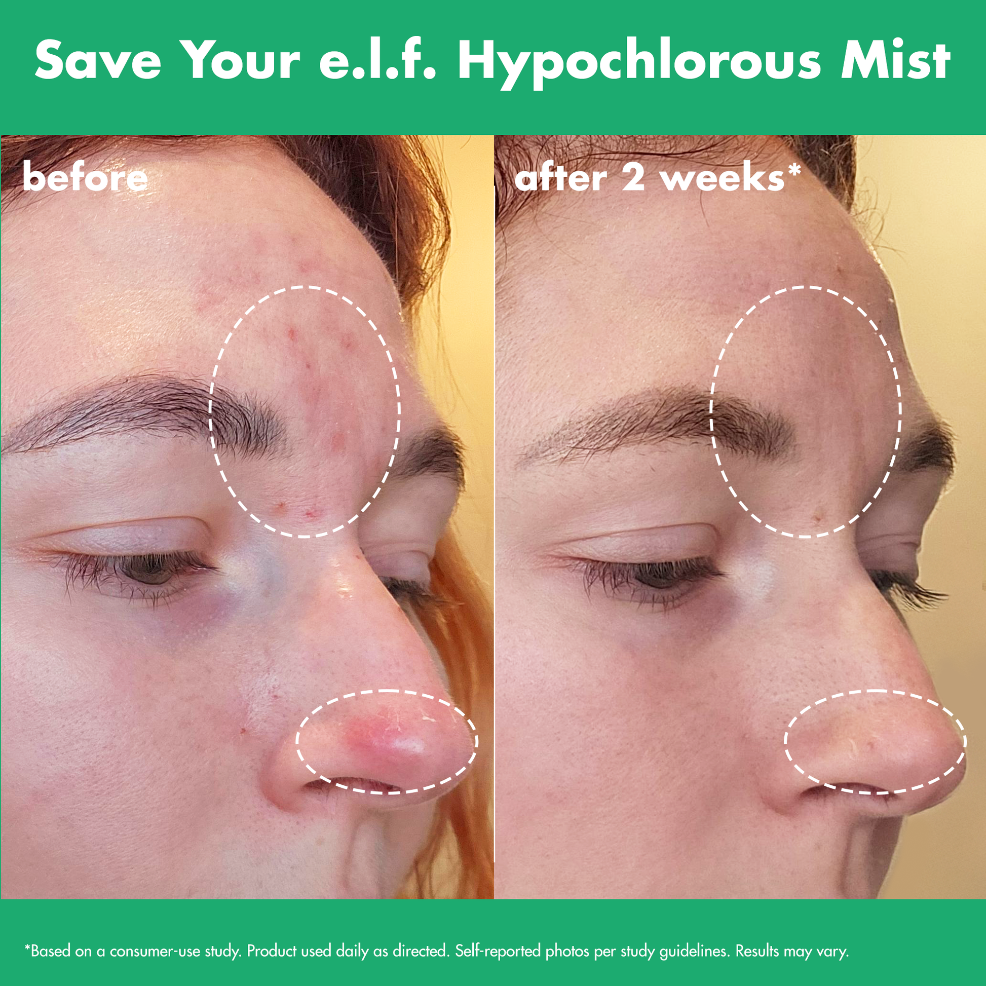 save-your-e-l-f-hypochlorous-mist-m4 FA26_EDUCATION_SAVEYOURELF_USAGE_BA1_WITHOUT_CLAIMS.png