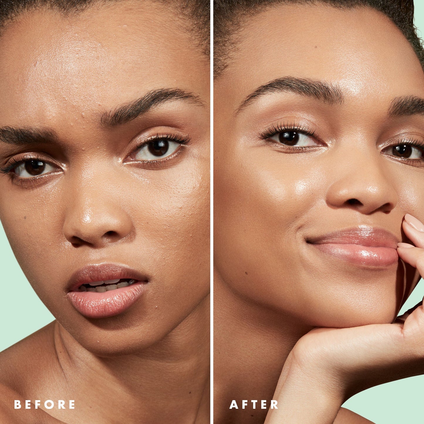 blemish-control-face-primer-large-size-i9 Primer_PP_Before_After_BlemishControl_2000x2000_3774231e-d4e1-49dd-b3d7-a73cbac901fe.jpg